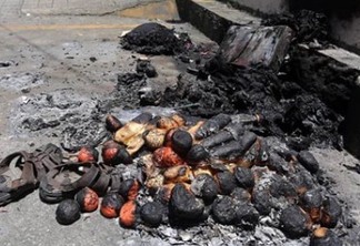 Paraibano é vítima de atentado no Rio de Janeiro e tem 19% do corpo queimado