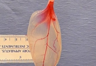Cientistas demonstram método que transforma espinafre em tecido de coração humano - VEJA VÍDEO