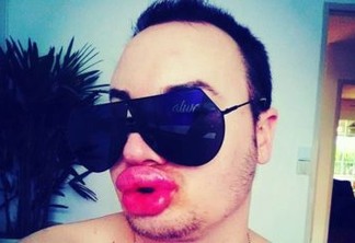 Jovem gasta R$ 48 mil para ter lábios iguais ao de Marilyn Monroe