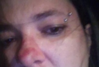 Jornalista paraibana é agredida com soco no rosto quando comemorava vitória de Bolsonaro