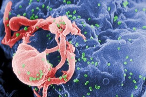 celula infectada HIV