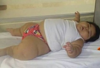 O que é a inflamação rara que fez bebê mexicano chegar aos 28 kg com dez meses de idade