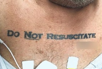 Homem com tatuagem 'não ressuscite' chega inconsciente a hospital e médicos entram em dúvida