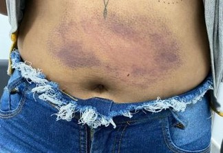 BARRAS DE FERRO, VIDRO E FACA: Ex-namorada de tatuador salva a atual após 11 dias de tortura - ENTENDA