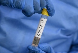 Israel anuncia descoberta de anticorpo para o Coronavírus