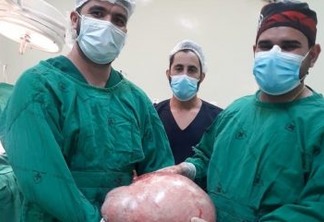 ASSUSTADOR: Com suspeita de gravidez, jovem procura médico e descobre tumor de 20 kg
