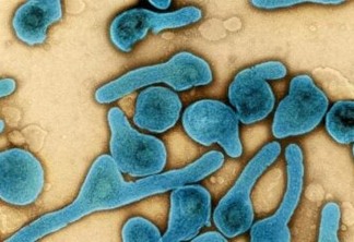 OMS confirma duas mortes pelo novo vírus Marburg, altamente infeccioso e tão mortal quanto o ebola