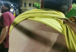 VIOLÊNCIA NA POLÍTICA PARAIBANA: após ser agredido em comício, deputado vai parar na delegacia - VEJA VÍDEO 