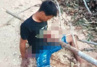 SURPREENDENTE: Rapaz fica com tronco atravessado no peito após acidente de moto