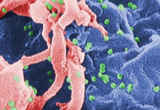 Cientistas conseguem expulsar o HIV de uma célula pela primeira vez