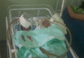 Bebês são incubados com máscaras feitas de garrafa PET em hospital