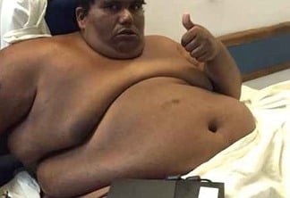 Paraibano Carlinhos recebe alta de Hospital após emagrecer mais de 150 quilos