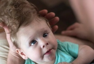 O bebê que surpreendeu os médicos ao sobreviver com o cérebro fora do crânio