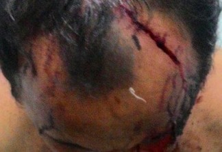 Briga em cabaré acaba com um ferido e dois presos no interior da Paraíba