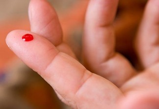 Anvisa aprova teste de HIV de farmácia