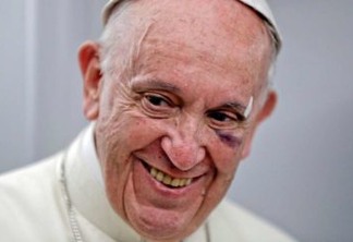 Papa Francisco se machuca no papamóvel