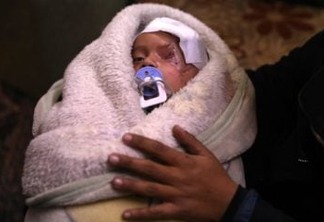EPA5201. DOUMA (SIRIA), 20/12/2017.- La tía de Karim, un niño herido en un bombardeo al este de Al-Guta, le sostiene en Duoma (Siria), hoy 20 de diciembre de 2017. El pasado 29 de octubre una mujer siria desplazada de Al-Qisa cogió a su hijo de 3 años Karim Abdul Rahman desde Beit Sawa (una zona pequeña que no tiene mercados, al este de Al-Guta) hacia Hamoria para comprar algunos víveres. Durante su compra, las fuerzas supuestamente leales al régimen Sirio bombardearon la zona causando la pérdida de uno de los ojos de Karim y la muerte de ella. Tras 10 días en el hospital le dieron el alta a su casa, donde la metralla de otro bombardeo le causó heridas en el cráneo. Activistas de todo el mundo lanzaron una campaña en solidaridad con Karim como símbolo del asedio que sufre la región del este de Al-Guta y cientos se unieron a ella globalmente en las redes sociales con el "hashtag" #SolidarityWithKarim, incluido el embajador británico para la ONU, Matthew Rycroft. EFE/ Mohammed Badra