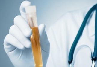 Cientistas detectam vírus da febre amarela pela primeira vez em urina e sêmen de paciente