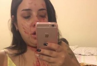Mulher agredida por ex posta foto ensanguentada, mas vira alvo de críticas