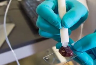 Pesquisadores revelam caneta que detecta câncer em segundos