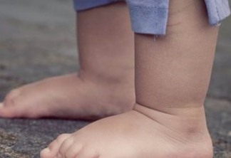 Menino de três anos morre após ser atropelado por vereador