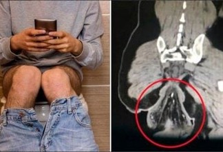 Distraído com celular, homem vai parar no hospital após ficar meia hora sentado no vaso