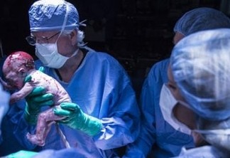 Brasil é o único país do mundo a ter bebê gerado em útero de mulher morta: VEJA VÍDEO