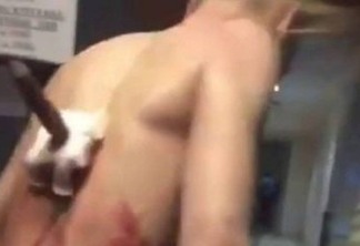 Paciente tenta deixar hospital com machado cravado nas costas