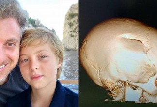 Luciano Huck publica foto de lesão do filho e faz alerta: 'Use capacete'