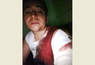 POR DIVERGÊNCIAS POLÍTICAS: Radialista leva facada do próprio pai após briga em bar no Sertão paraibano
