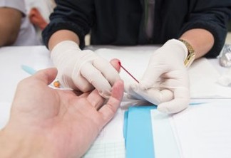 FALHA NA PREVENÇÃO: Brasil registrou 145 novos casos de HIV por dia em 2018 - Jamil Chade