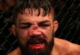Americano fica com nariz desfigurado em derrota para brasileiro no UFC