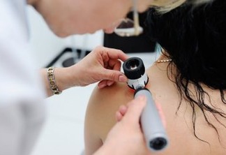 Paraíba estima 1.700 novos casos de câncer de pele e dermatologista explica como identificar doença