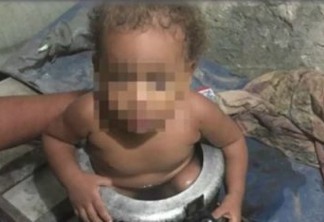 Menina de 1 ano fica presa em panela de pressão na Grande Recife