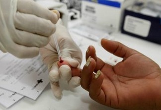 Justiça proíbe exame de HIV em concursos públicos