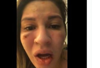 GRAVOU VÍDEO DESESPERADA: Esposa de goleiro tricolor denuncia agressão com rosto cheio de hematomas