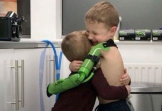 Criança recebe prótese para braço amputado e abraça irmão pela primeira vez