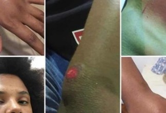 RACISMO: Grupo de jovens negros é linchado por usar 'banheiro de brancos' em bar do Rio de Janeiro