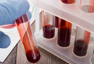 Hospital Metropolitano realiza primeira transfusão de plasma convalescente