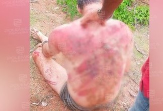 HOMOFOBIA: Professor leva surra de chicote no Cariri paraibano após divulgação de vídeo íntimo