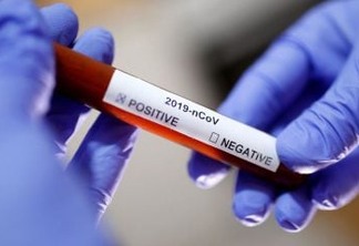 Brasil tem 132 casos suspeitos de coronavírus