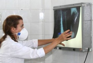 OUTRO INIMIGO ESPREITA: Brasil registra 200 novos casos de tuberculose por dia