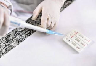 Agevisa estabelece normas para testes de detecção do coronavírus em laboratórios clínicos privados da Paraíba