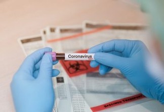 Usuário de plano de saúde tem direito a testes diagnósticos para o Coronavírus, alerta Procon-JP