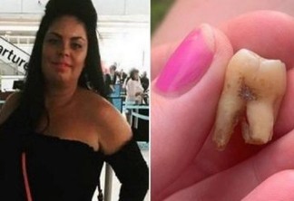 Sem dentista disponível, mulher toma 4 cervejas antes de arrancar dente sozinha
