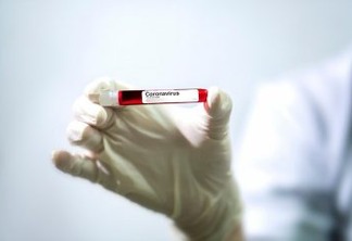 Brasil começa a testar vacina de Oxford para Covid-19 neste mês