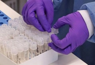 COVID-19: Oxford prevê concluir pesquisa de vacina até agosto