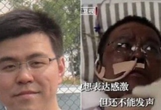 Morre médico que ficou com pele escura durante tratamento para Covid-19 em Wuhan