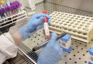 Tratamento para coronavírus: cientistas testam droga experimental contra coágulos sanguíneos