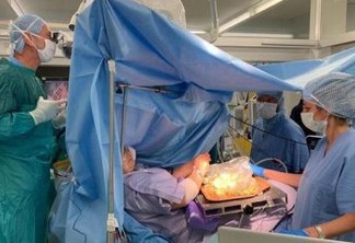 Mulher recheia azeitonas enquanto médicos operavam o seu cérebro